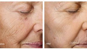 CosmoPeel4